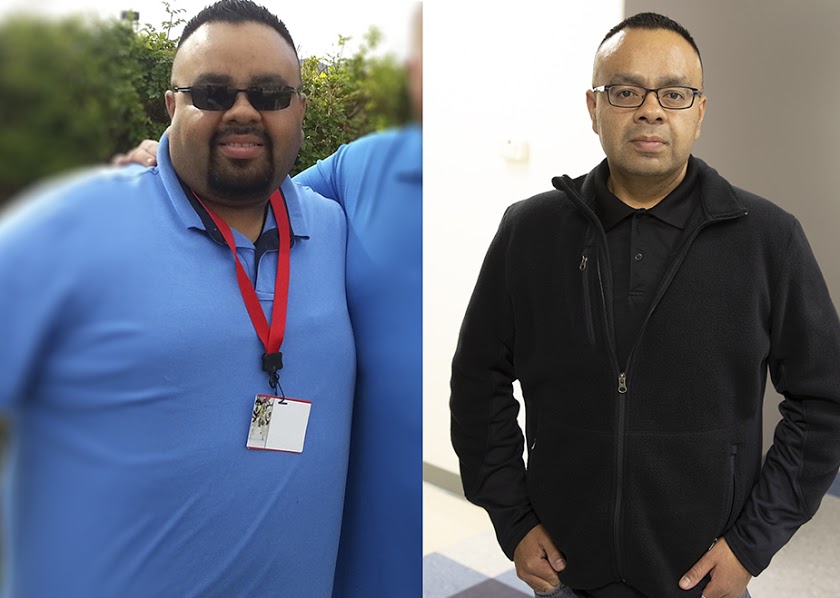 glen before and after weight loss surgery